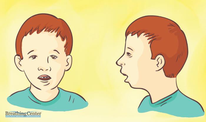 Enlarged adenoids can change the face of the child
