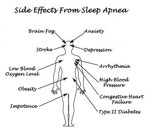 Sleep apnea can be stopped by Buteyko
